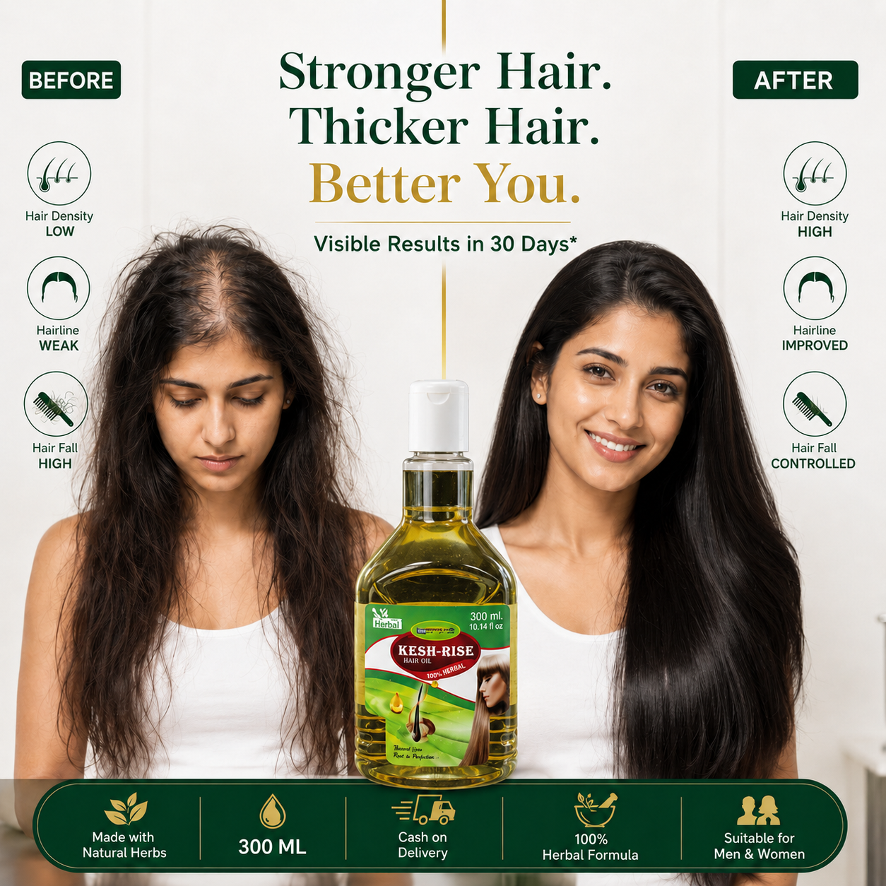 Kesh Rise Herbal Hair Growth Oil 300ml | Reduces Hair Fall & Promotes Thicker, Healthier Hair
