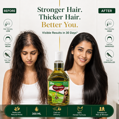 Kesh Rise Herbal Hair Growth Oil 300ml | Reduces Hair Fall & Promotes Thicker, Healthier Hair