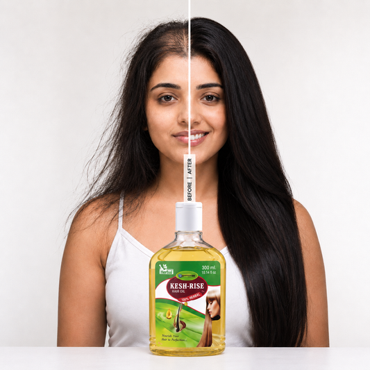 Kesh Rise Herbal Hair Growth Oil 300ml | Reduces Hair Fall & Promotes Thicker, Healthier Hair
