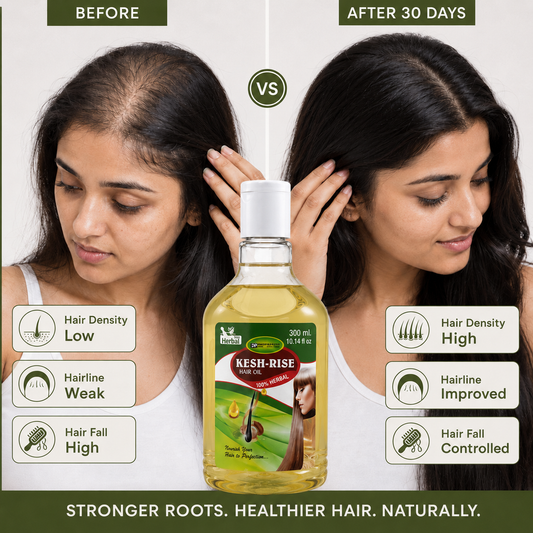 Kesh Rise Herbal Hair Growth Oil 300ml | Reduces Hair Fall & Promotes Thicker, Healthier Hair